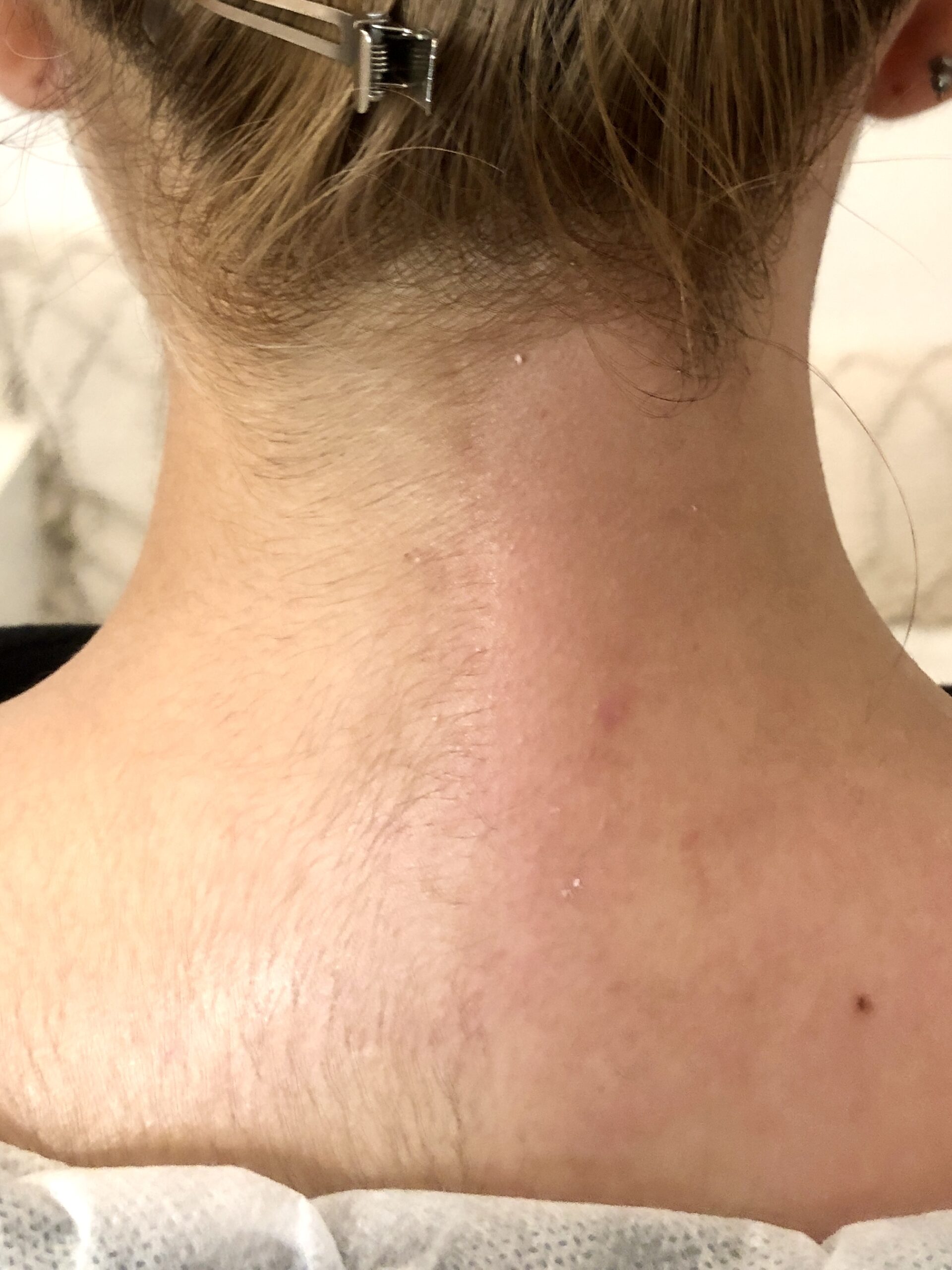 首ワックス脱毛